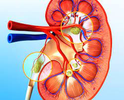 SANATH HOMEO CLINIC - Latest update - Kidney Stoney Treatment In Hormavu